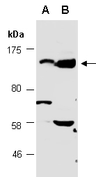MAP3K15 Antibody Western (Abiocode)