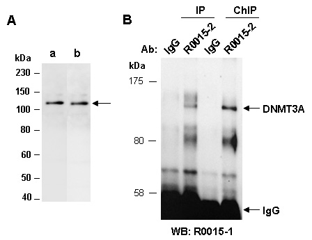 DNMT3A Western Antibody (ABiocode)