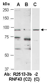 RNF43 Antibody Western (Abiocode)