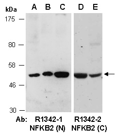 NFKB2 Antibody Western (Abiocode)