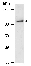 NFKB2 Antibody Western (Abiocode)