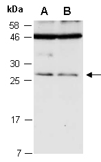 TIMP3 Antibody Western (Abiocode)