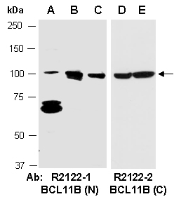 BCL11B Antibody Western (Abiocode)