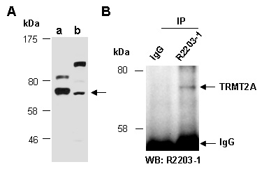 TRMT2A Western IP Antibody (Abiocode)