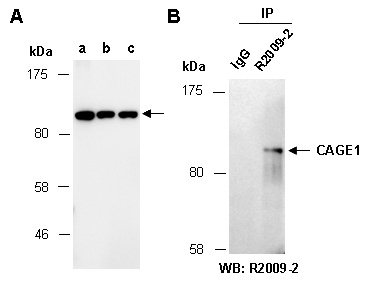 CAGE1 Western IP Antibody (Abiocode)