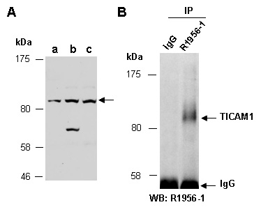 TICAM1 Western IP Antibody (Abiocode)