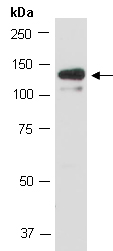 SENP6 Antibody Western (Abiocode)
