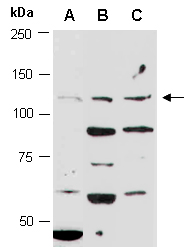 ADCY2 Antibody Western (Abiocode)