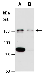 PDE3B Antibody Western (Abiocode)