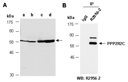 PPP2R2C Western IP Antibody (Abiocode)
