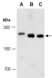 DNMT1 Western Antibody (Abiocode)