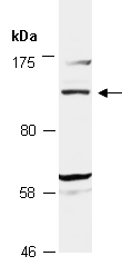 SREBP1 Antibody Western (Abiocode)