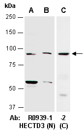 HECTD3 Antibody Western (Abiocode)