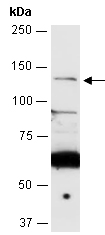 REST Antibody Western (Abiocode)