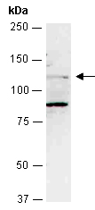 CDKL5 Antibody Western (Abiocode)