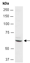CCT2 Antibody Western (Abiocode)