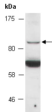 TLR2 Antibody Western (Abiocode)