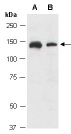 NTRK2 Antibody Western (Abiocode)