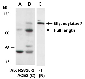 ACE2 Antibody Western (Abiocode)