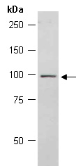 TARSL2 Antibody Western (Abiocode)