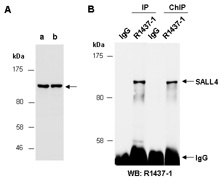 SALL4 Western IP ChIP Antibody (Abiocode)