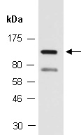 TPRC6 Antibody Western (Abiocode)