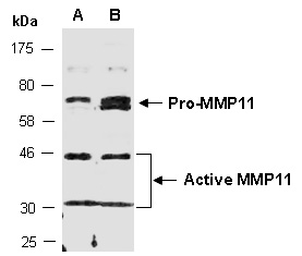 MMP11 Antibody Western (Abiocode)