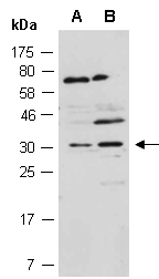 SRSF7 Antibody Western (Abiocode)