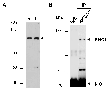 PHC1 Western IP Antibody (Abiocode)