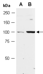 TLR3 Antibody Western (Abiocode)