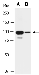 GRIN1 Antibody Western (Abiocode)