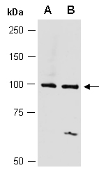 PIK3C3 Antibody Western (Abiocode)