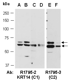 KRT14 Antibody Western (Abiocode)