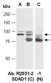 SDAD Antibody Western (Abiocode)