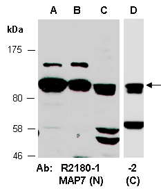 MAP7 Antibody Western (Abiocode)