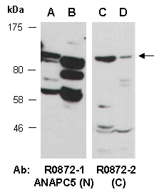 ANAPC5 Antibody Western (Abiocode)