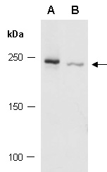 KAT6A Antibody Western (Abiocode)