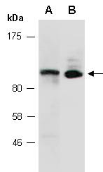 CNOT3 Antibody Western (Abiocode)
