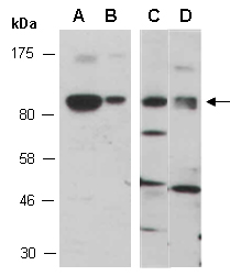 ACSL3 Antibody Western (Abiocode)