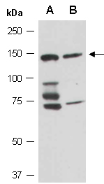 MKL1 Antibody Western (Abiocode)