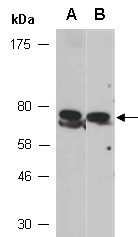 CD248 Antibody Western (Abiocode)