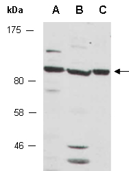 BRD3 Antibody Western (Abiocode)