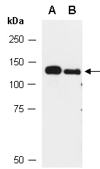TJP3 Antibody Western (Abiocode)