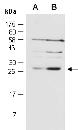 SRA1 Antibody Western (Abiocode)