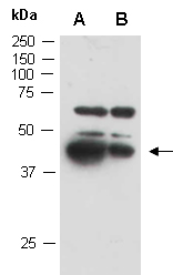 ANXA1 Antibody Western (Abiocode)