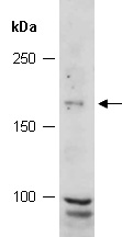 COL11A1 Antibody Western (Abiocode)
