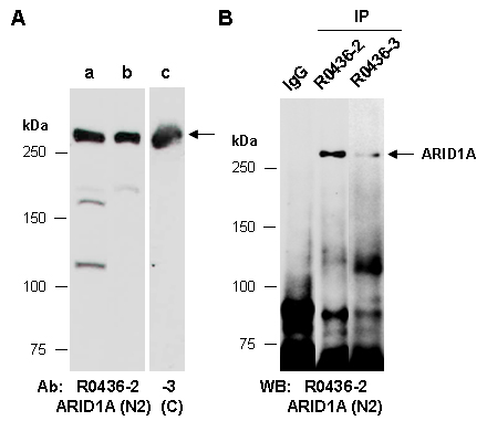 ARID1A Antibody Western (Abiocode)
