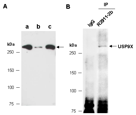 USP9X Antibody Western (Abiocode)