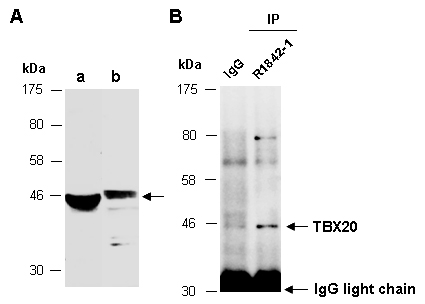TBX20 Western IP Antibody (Abiocode)