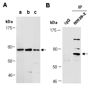 GPR153 Western Antibody IP (Abiocode)